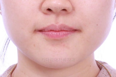 부산인비절라인