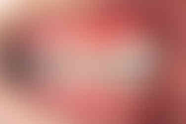 부산토끼치아교정