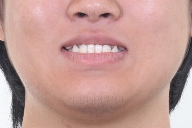 연산동교정
