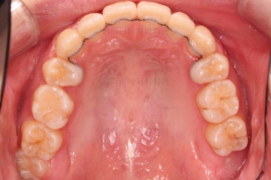 부산돌출입교정