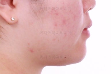 부산치아교정치과