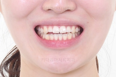 부산교정치과