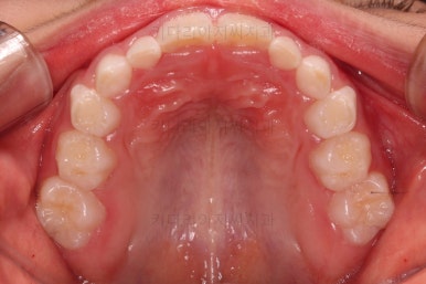 부산어린이교정