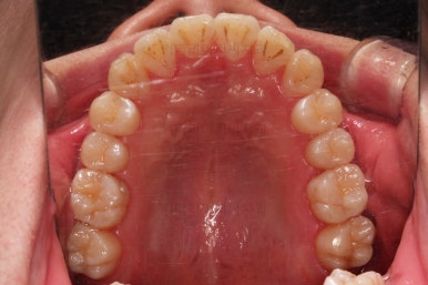 부산인비절라인