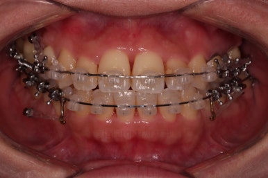 부산연산동치과