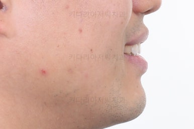 부산교정치과추천