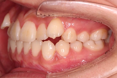 연산동교정치과