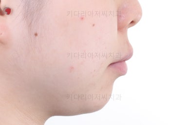 부산연산동교정치과