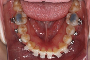 연산동교정치과