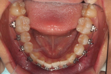 부산연산동청소년교정