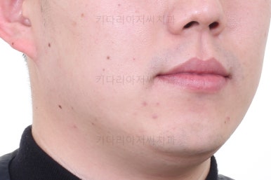 부산인비절라인