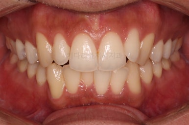 부산연제구교정