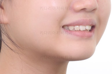 부산교정전문의