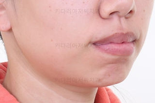 부산치아교정