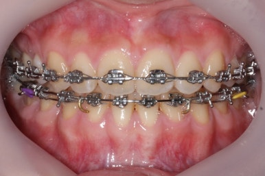 부산교정전문의