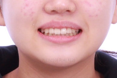 부산교정전문의