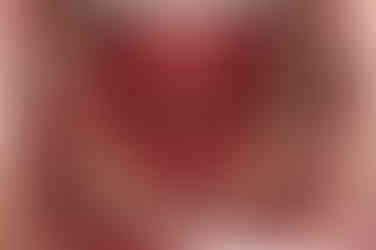 연산동임플란트