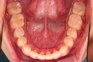 부산연산역치아교정