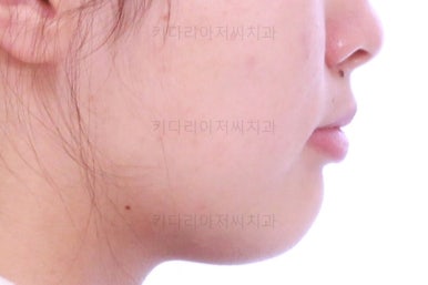 부산치아교정치과