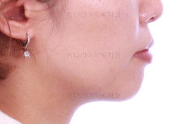 부산연산동교정치과