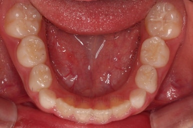 부산어린이교정