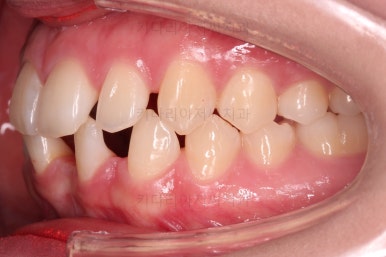 부산교정치과추천