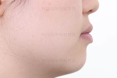부산교정치과