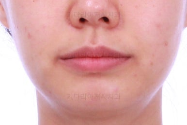 부산치아교정잘하는치과