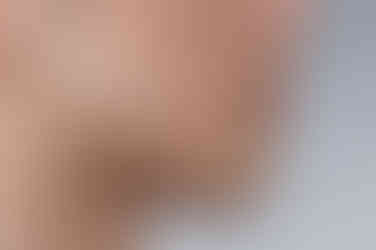 부산주걱턱교정