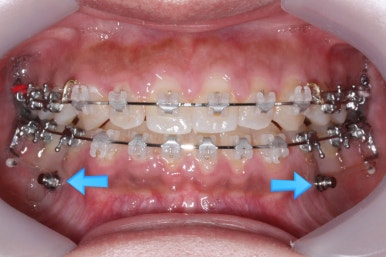 부산치아교정치과