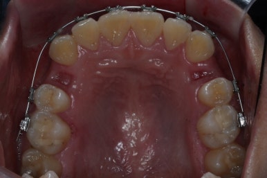 부산교정전문의