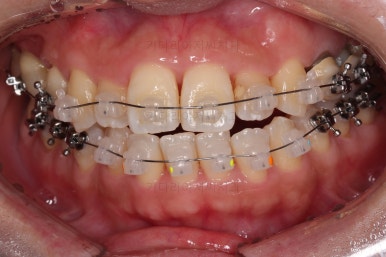 부산연산동치과