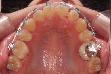 동래구치아교정