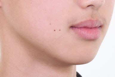 부산치아교정전문의