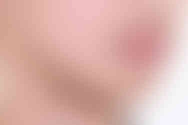 부산치아교정전문의