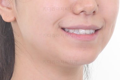부산교정잘하는치과
