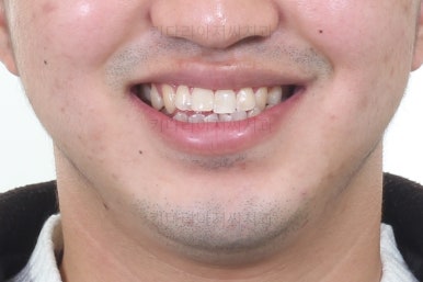 연산동교정전문치과