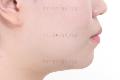 부산교정전문의