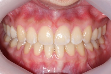 부산교정전문의