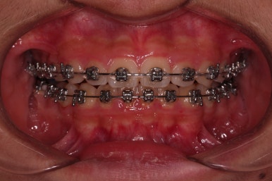 부산청소년교정