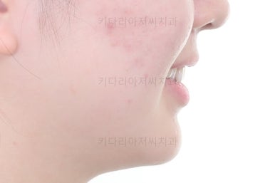 부산치아교정잘하는곳