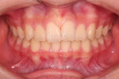 부산교정전문의