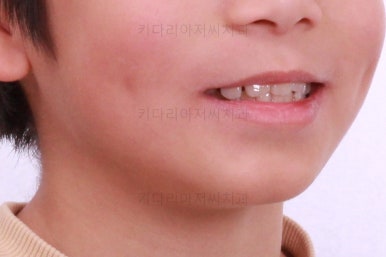 부산어린이교정