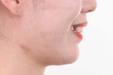 연산동교정치과