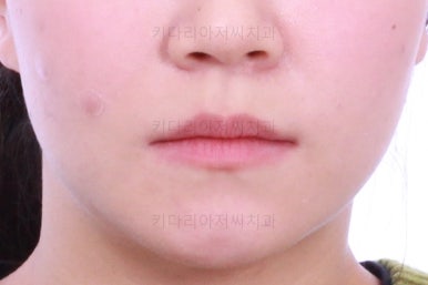 부산교정전문의