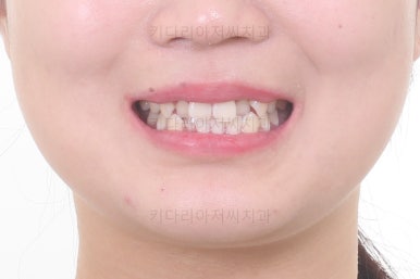 부산치아교정치과