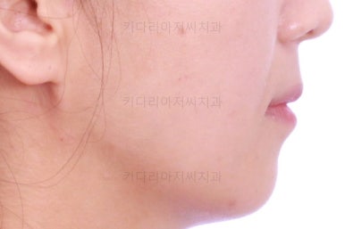 부산인비절라인