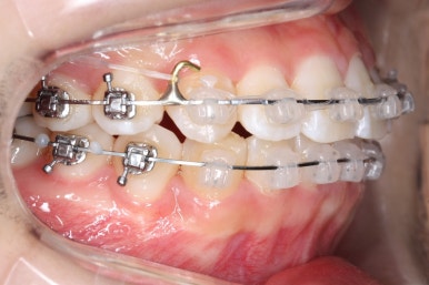 연산동교정치과