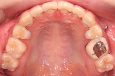 동래구치아교정