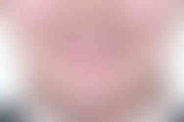 부산임플란트교정